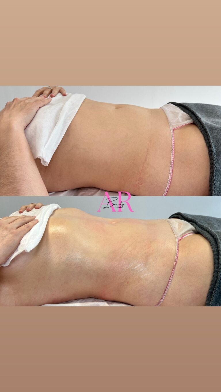 ARANTZAZU ESCOBERO CAMACHO6